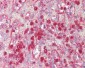 PIAS3 Antibody (aa10-59)